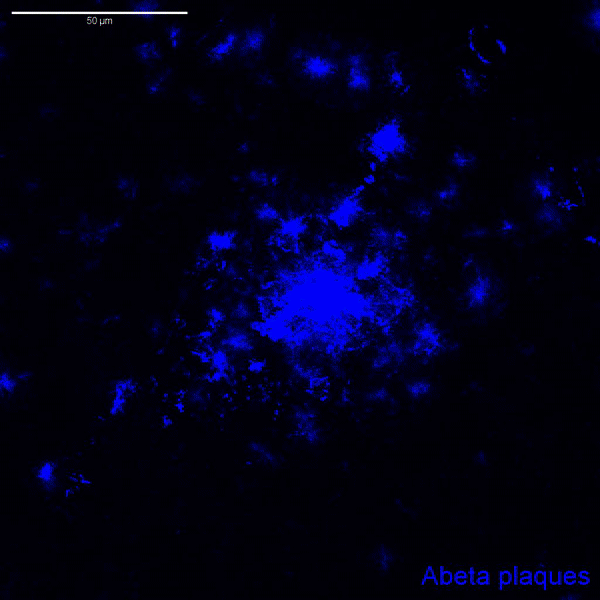 This movie highlights the "territories" astrocytes occupy in green, the astrocyte processes themselves in red, and amyloid plaques in blue.