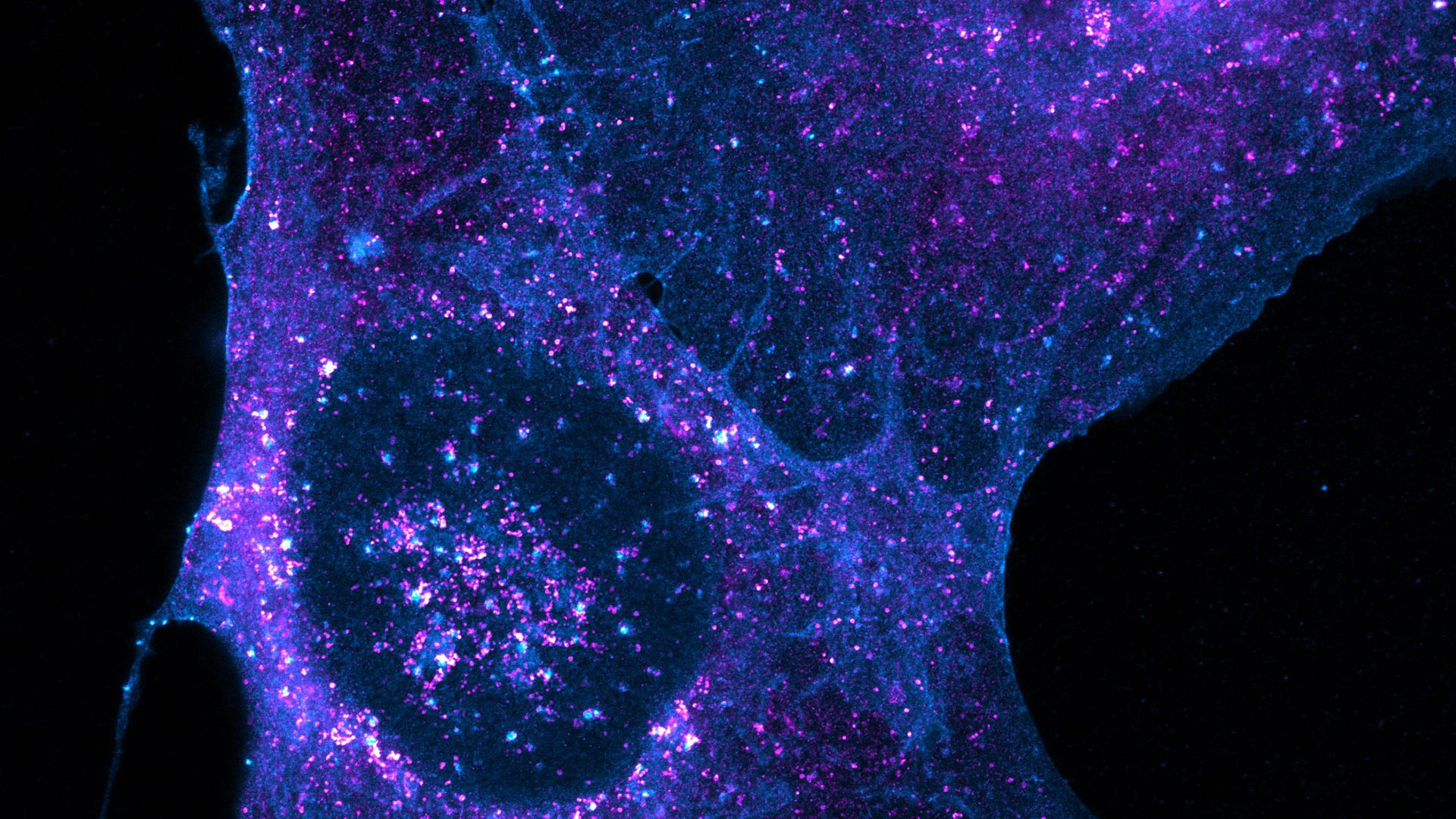 http://Scientific%20image%20from%20Allen%20Distinguished%20Investigator%20Andre%20Nadler