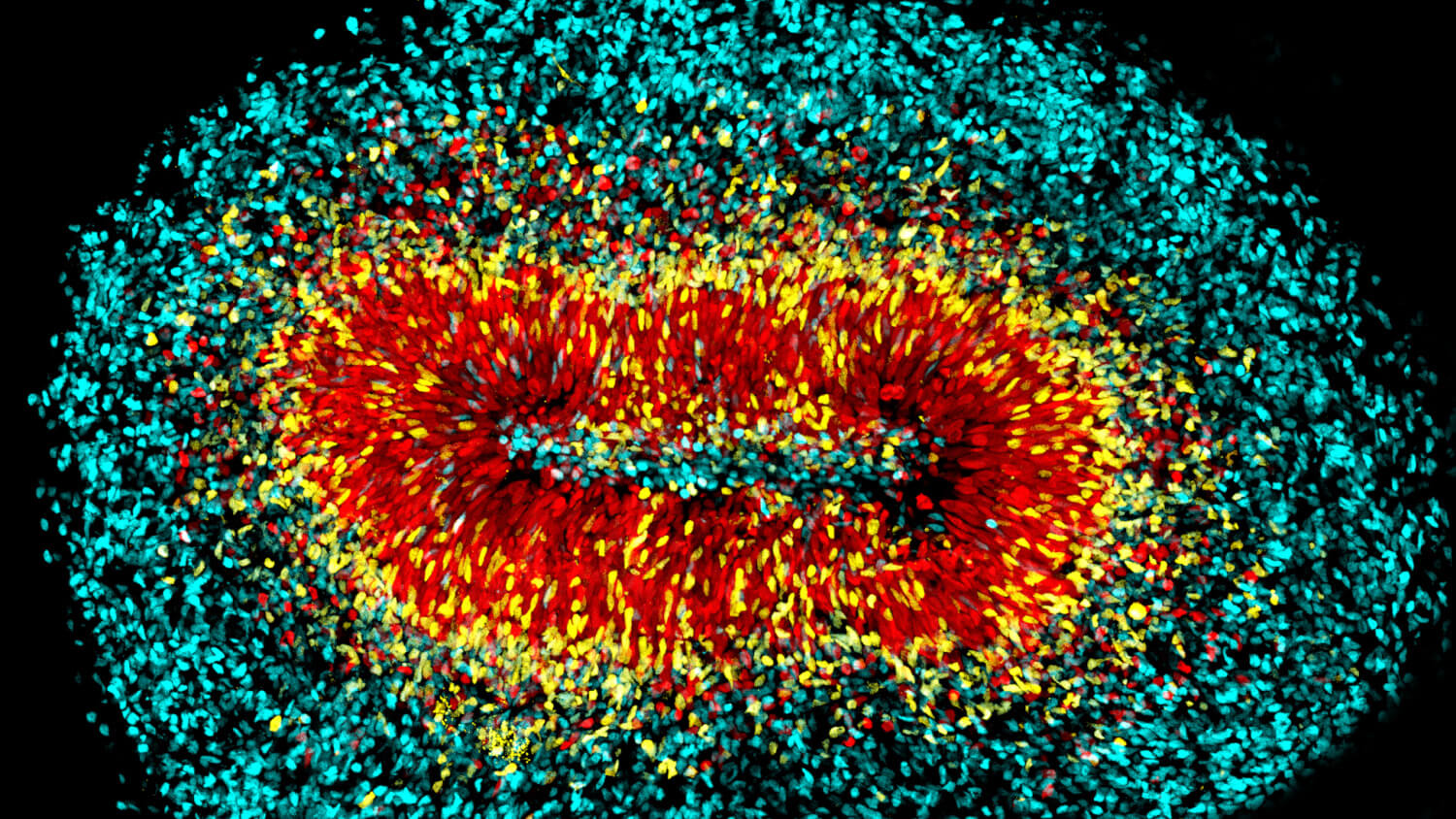 Researchers in the laboratory of Christopher Walsh, M.D., Ph.D., are using brain organoids derived from human stem cells to understand the role of certain DNA sequences in our evolution. Image courtesy of Xuyu Qian, Ph.D.