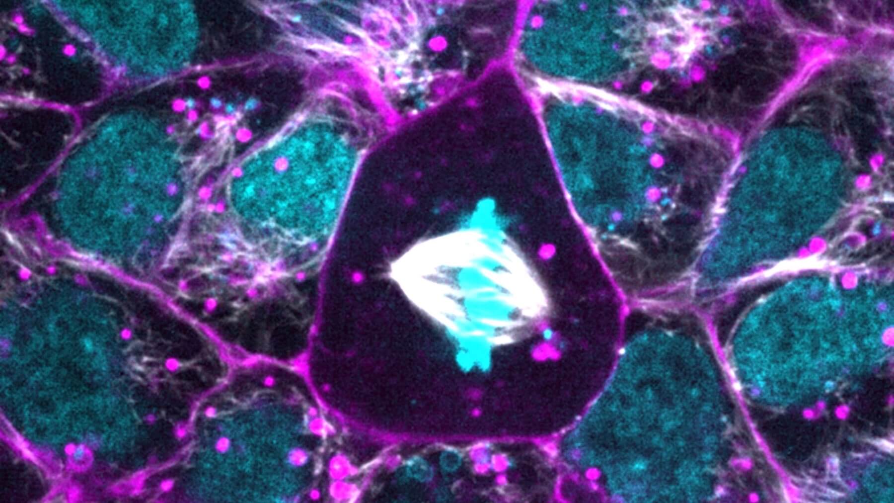 http://Image%20from%20the%20Allen%20Cell%20Collection%20of%20human%20iPS%20cells%20expressing%20Tubulin