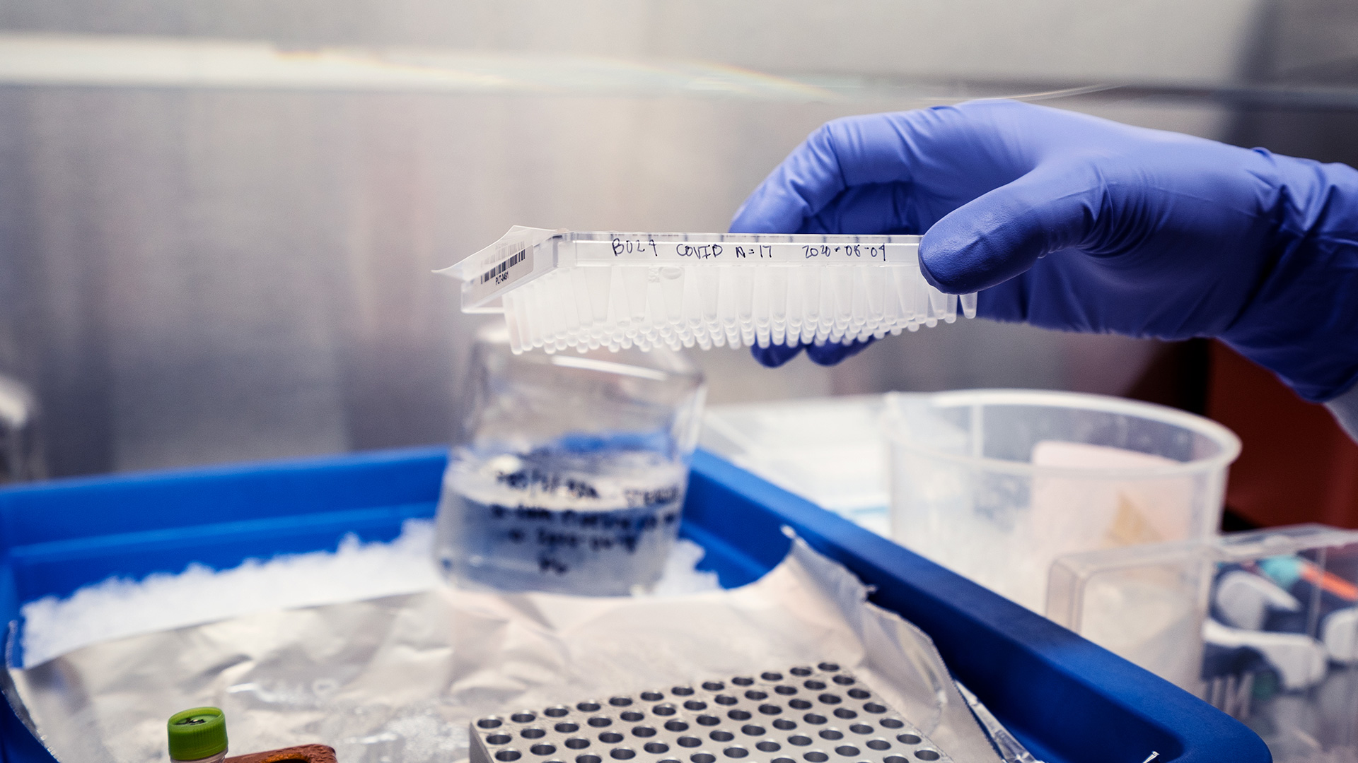 Hand carrying a tray of biological samples in a laboratory