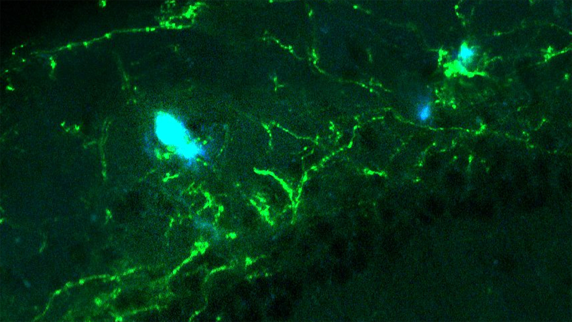 Alzheimer-Brain HPC with axons and plaques zoomed