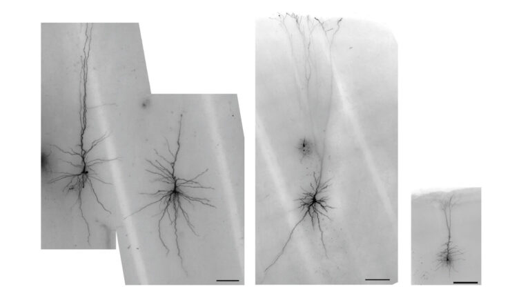Stained neurons shown in slices of brain tissue from a human brain surgery patient who donated their tissue to research (two left images), a macaque monkey (second from right) and mouse brain (right). Allen Institute researchers are able to capture electrical information from these live human neurons, as well as their 3D shape and gene expression, through a technique known as Patch-seq. The human and macaque neurons are Betz cells, huge and specialized motor neurons that connect all the way to the spinal cord. These cells are a striking example of how similar types of neurons show specialization through evolution. The closest rodent relative to the primate Betz cell has very different features.