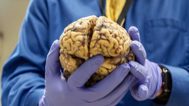 Scientist holding human brain that was donated to science