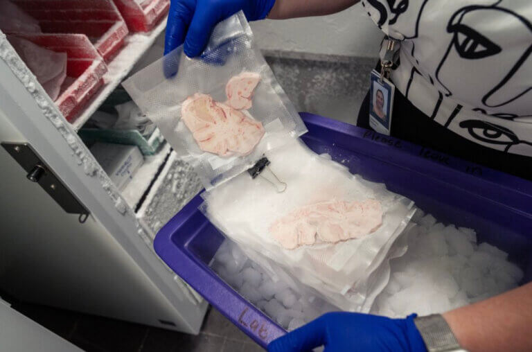 Human brain slice