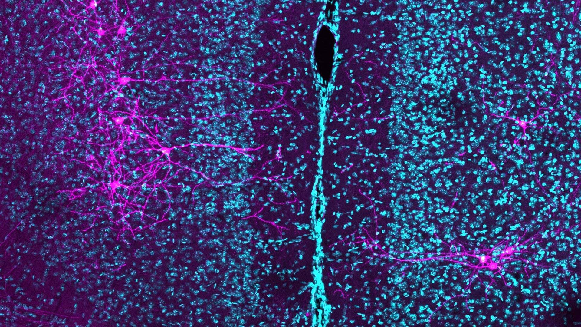 http://image%20of%20the%20brain%20showing%20many%20cell%20bodies%20an%20IT%20neurons%20emphasised