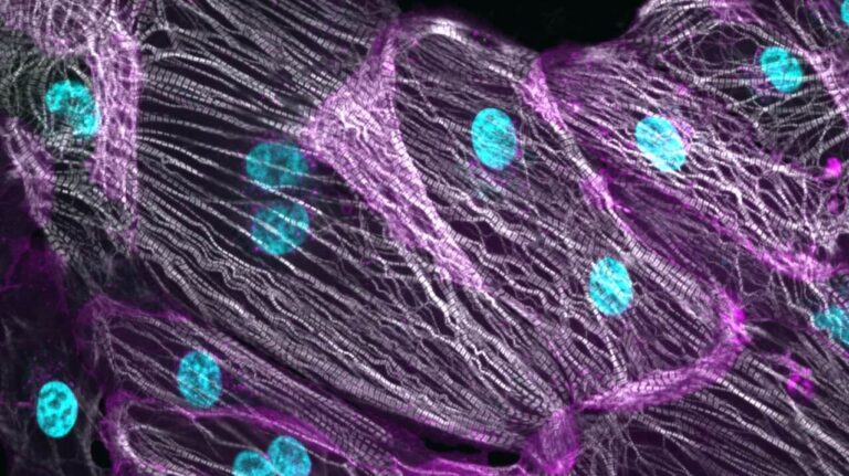 Image of a cardiomyocyte
