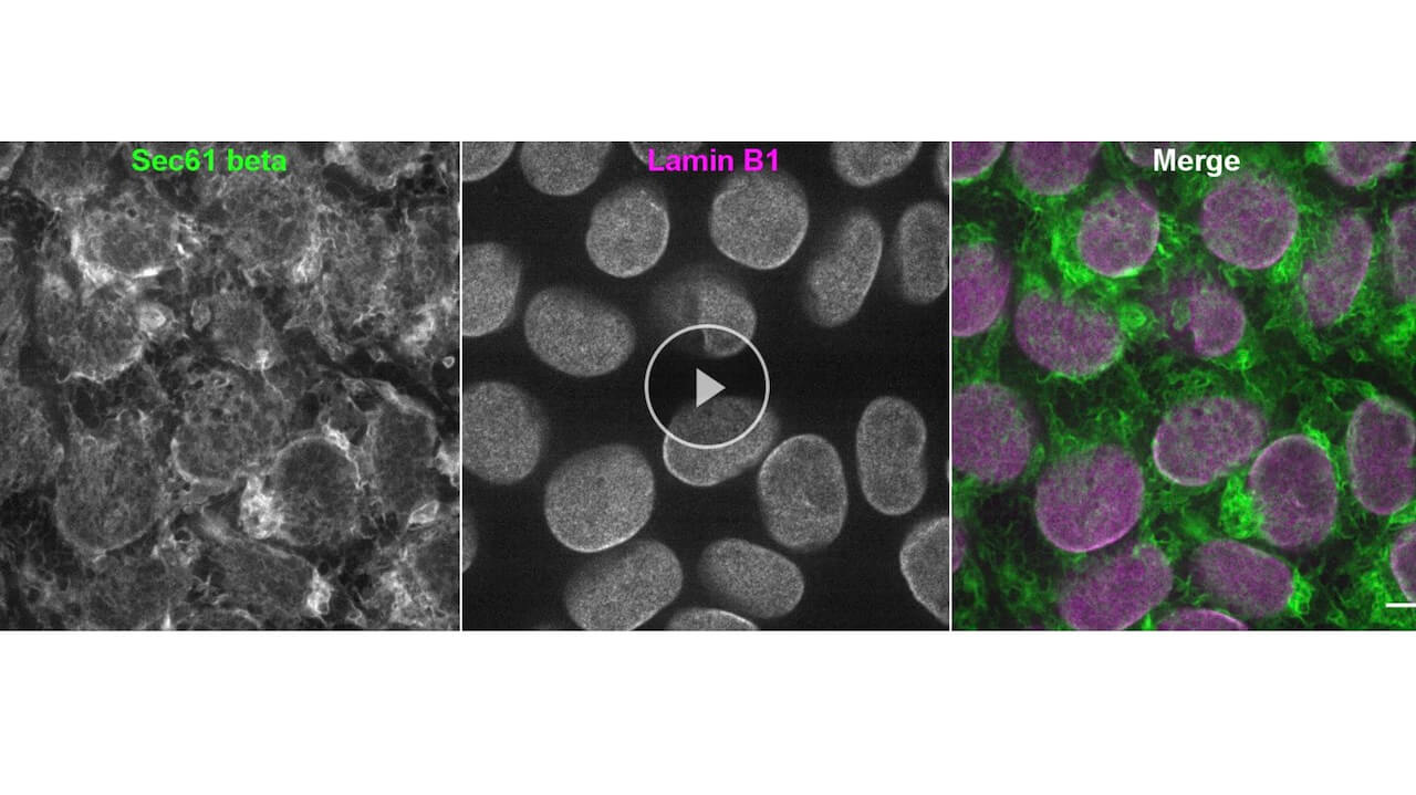 Human Stem Cell Observations