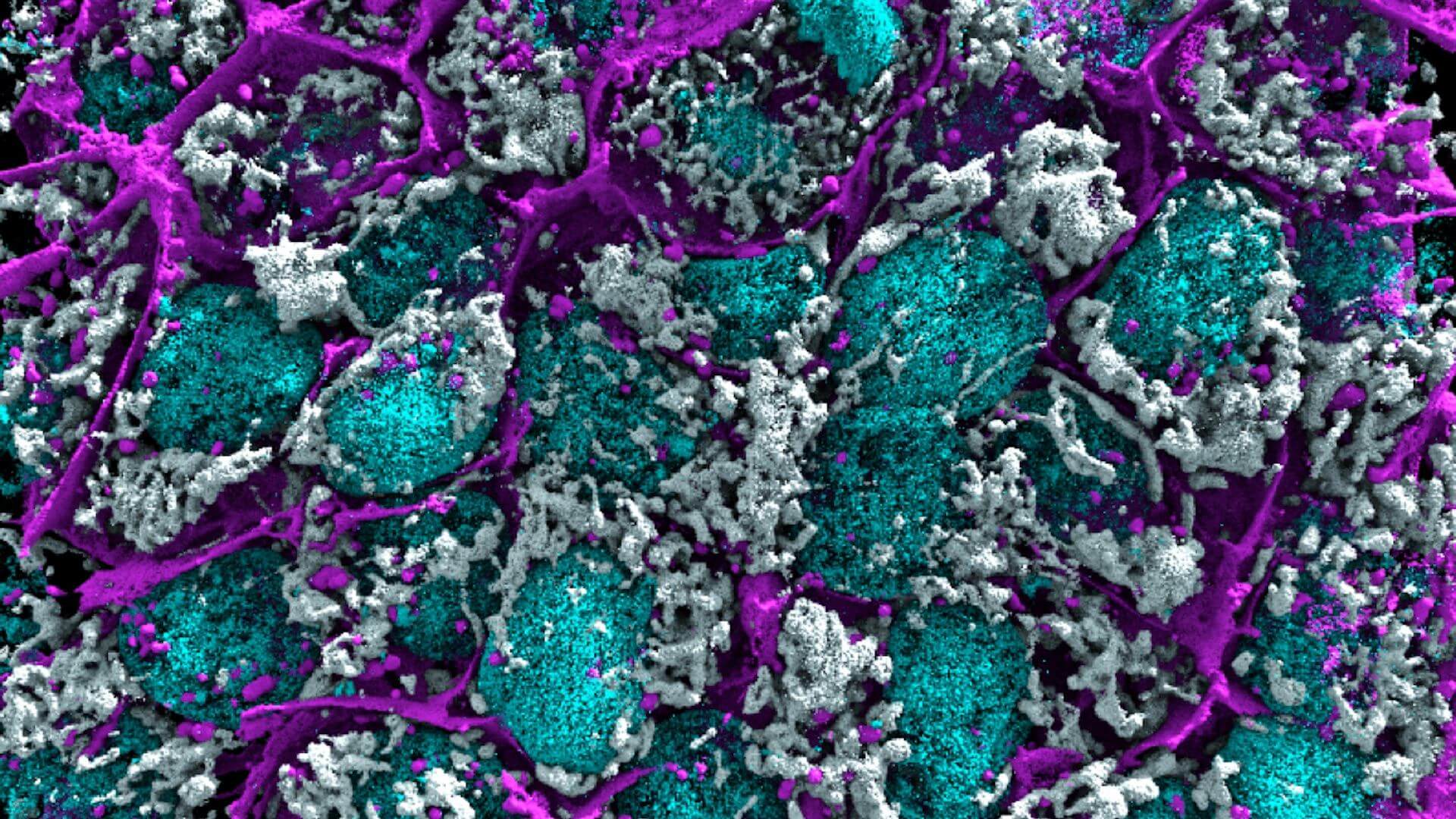 Image of human cells dynamically imaged in high contrast using AGAVE imaging technology.