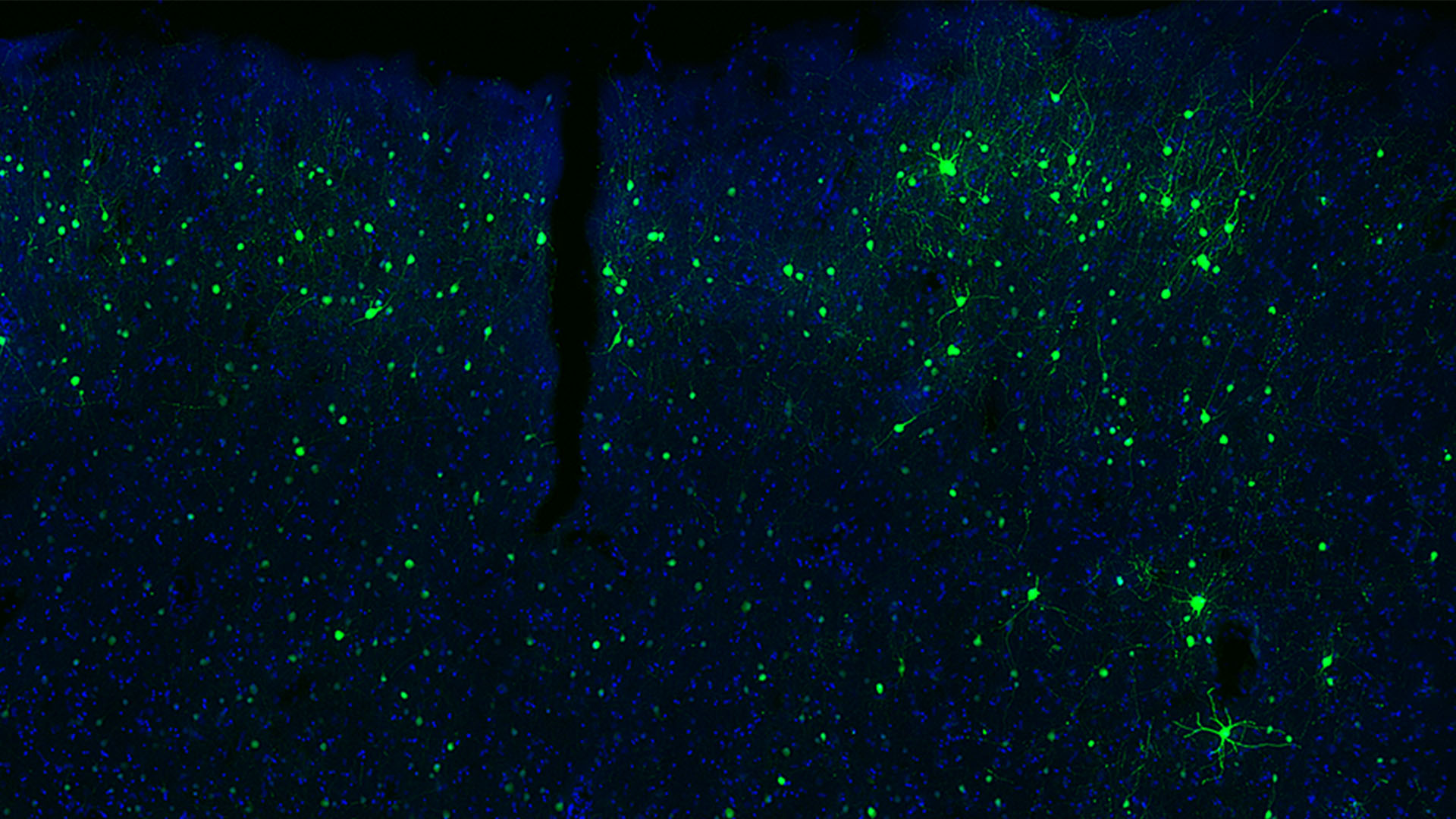 http://A%20new%20technique%20lets%20scientists%20watch%20live%20neurons%20in%20glowing%20color.%20Here,%20a%20piece%20of%20human%20brain%20tissue,%20donated%20by%20a%20patient%20undergoing%20brain%20surgery%20in%20the%20Seattle%20area,%20is%20lit%20up%20in%20green%20and%20blue%20thanks%20to%20a%20modified%20virus%20that%20delivers%20fluorescent%20labels%20only%20to%20a%20single%20class%20of%20neuron%20in%20the%20brain.%20Green%20cells%20are%20inhibitory%20neurons;%20blue%20are%20all%20cells.