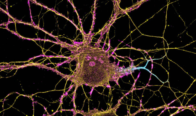 Human brain cell