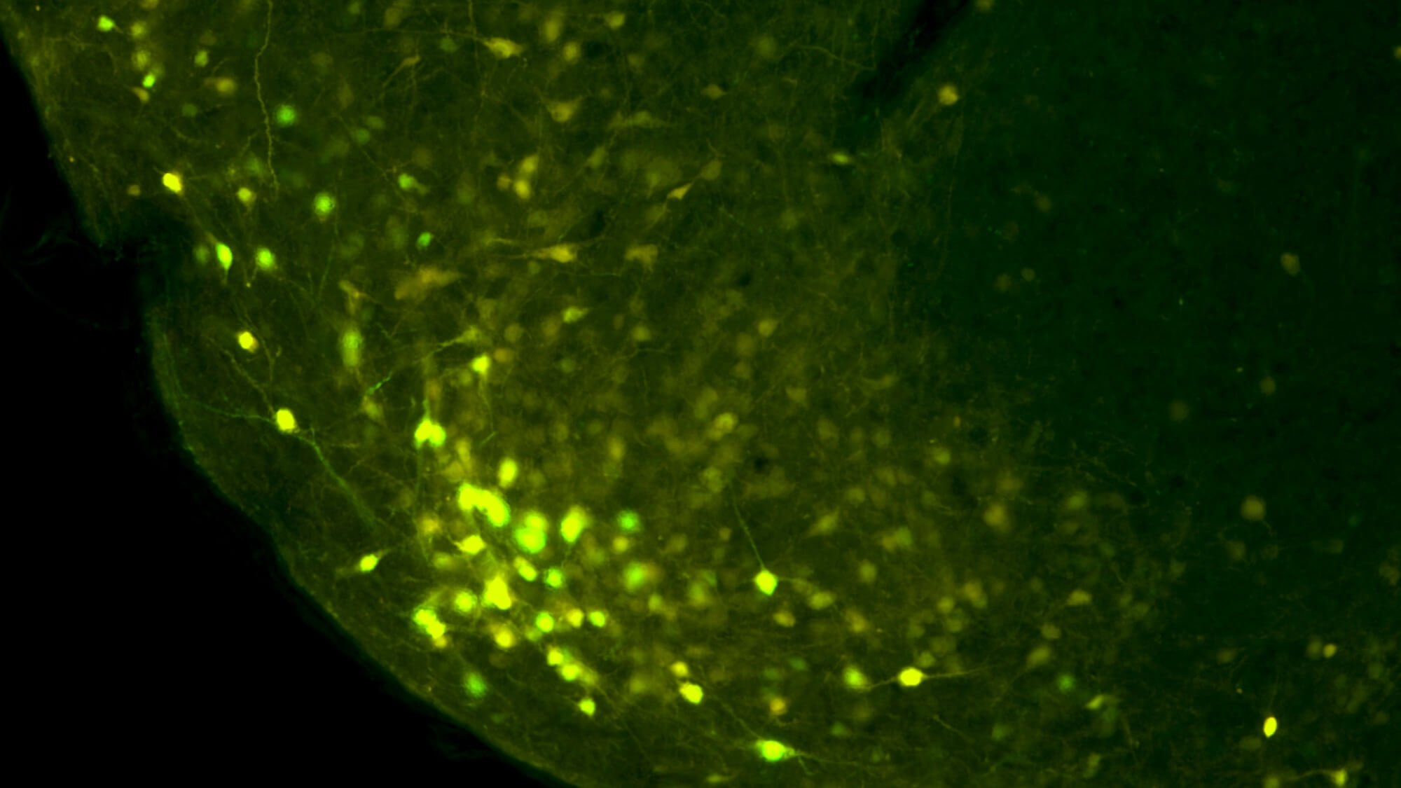 http://ADI%20Science%20Image%20showing%20illuminated%20neurons