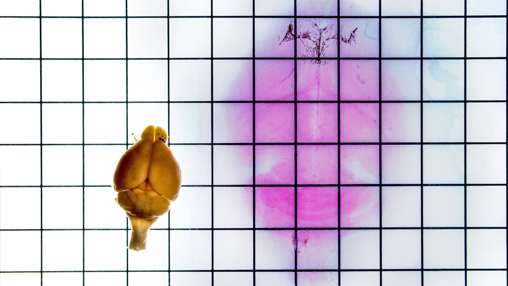 normal mouse brain next to a transparent expanded mouse brain