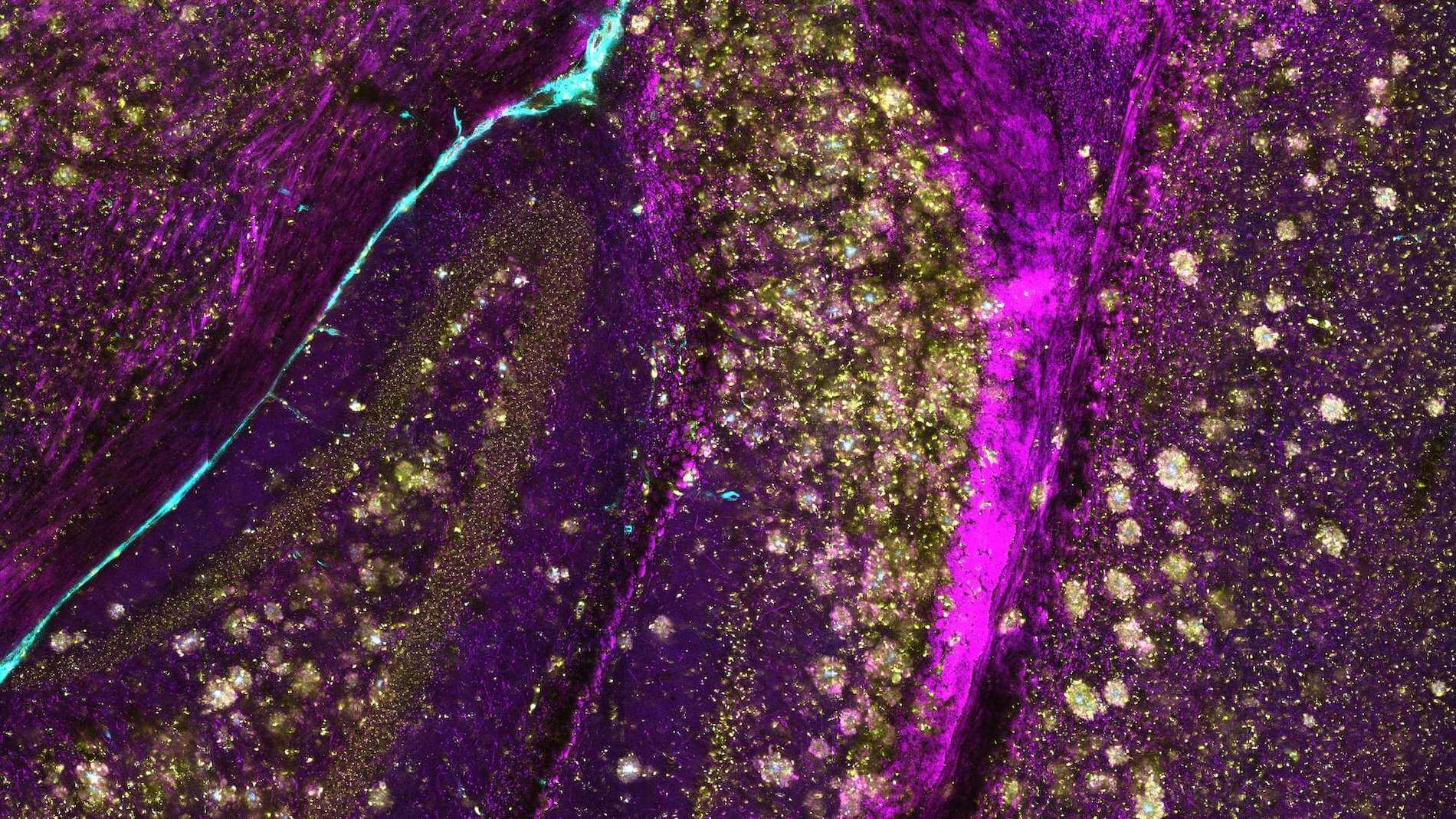 http://histology%20image%20showing%20extracellular%20vesicles%20in%20live%20tissues