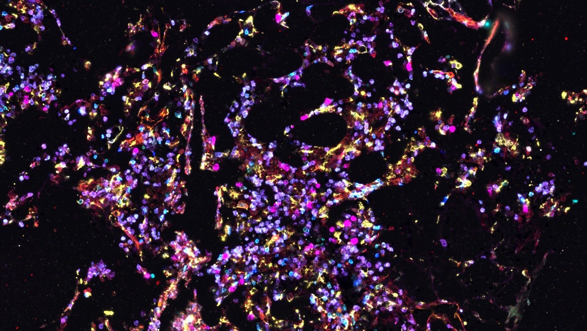 http://Histology%20image%20of%20healthy%20human%20bone%20marrow