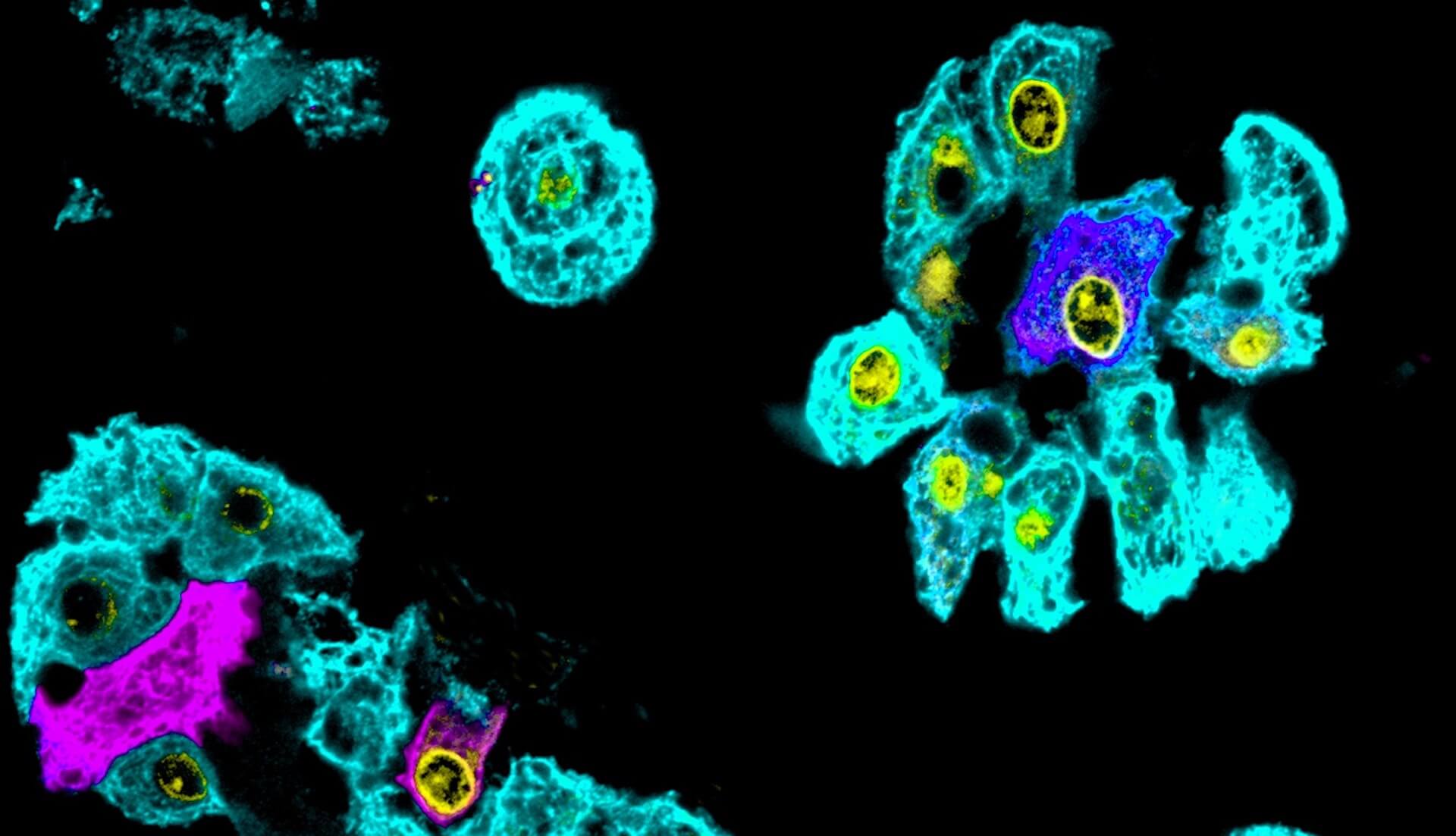 http://liver%20organoids