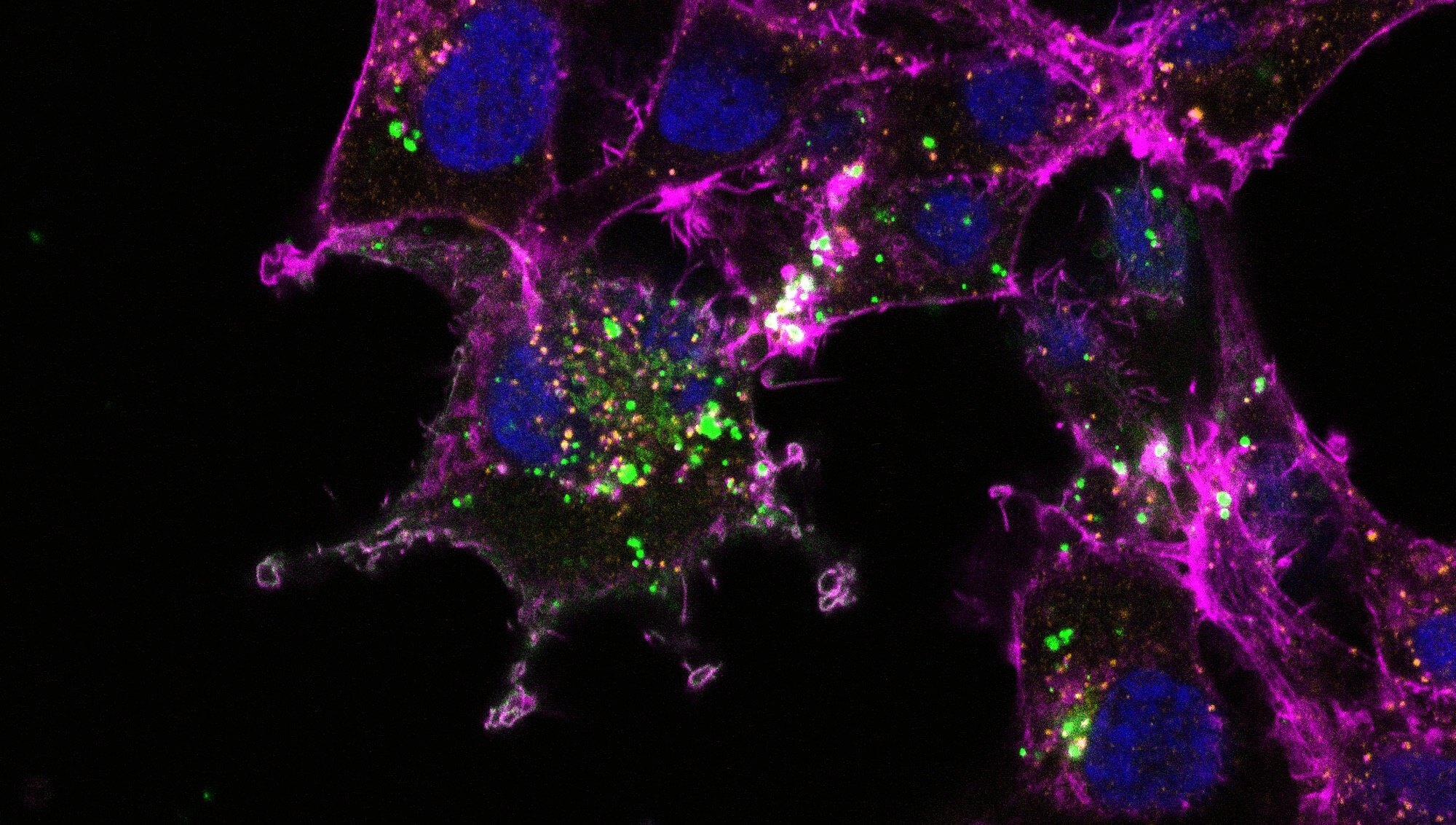 http://Science%20image%20from%20Allen%20Distinguished%20Investigator%20Kenneth%20Witwer