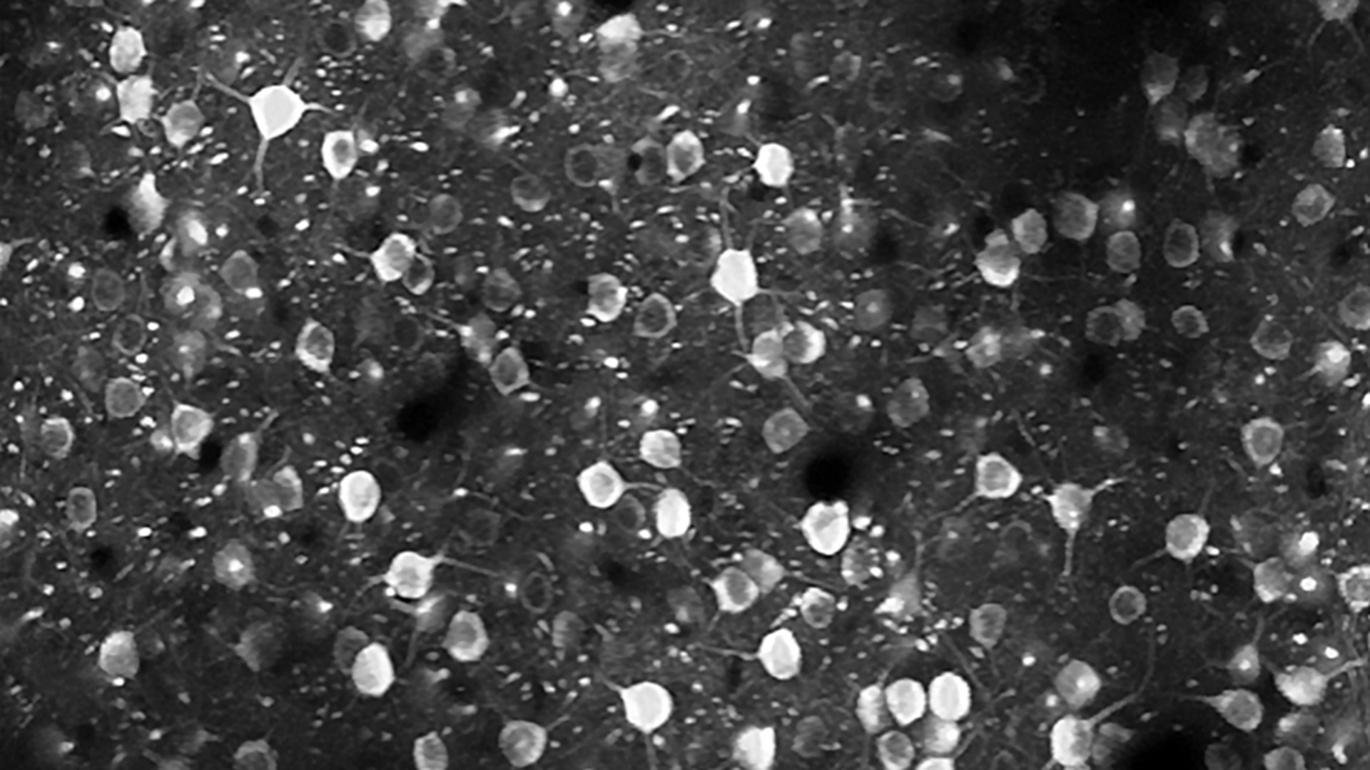 MindScope Allen Institute calcium imaging illuminates neurons