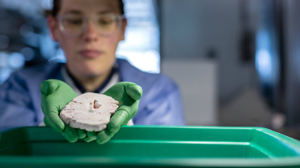 Rebecca Hodge, Ph.D., a scientist at the Allen Institute for Brain Science, holds a section of postmortem human brain used in the study