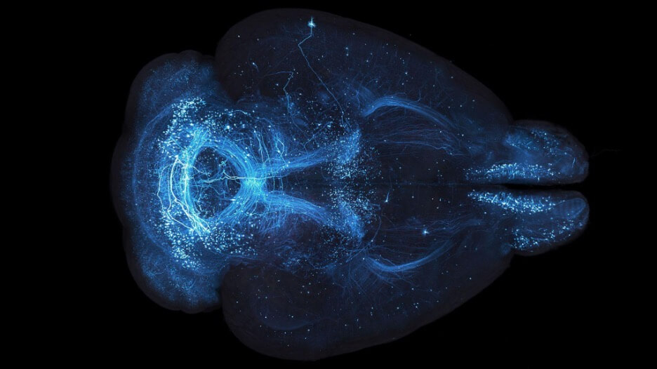 High-resolution brain-wide imaging of axonal arbors to examine connectivity in defined cell types