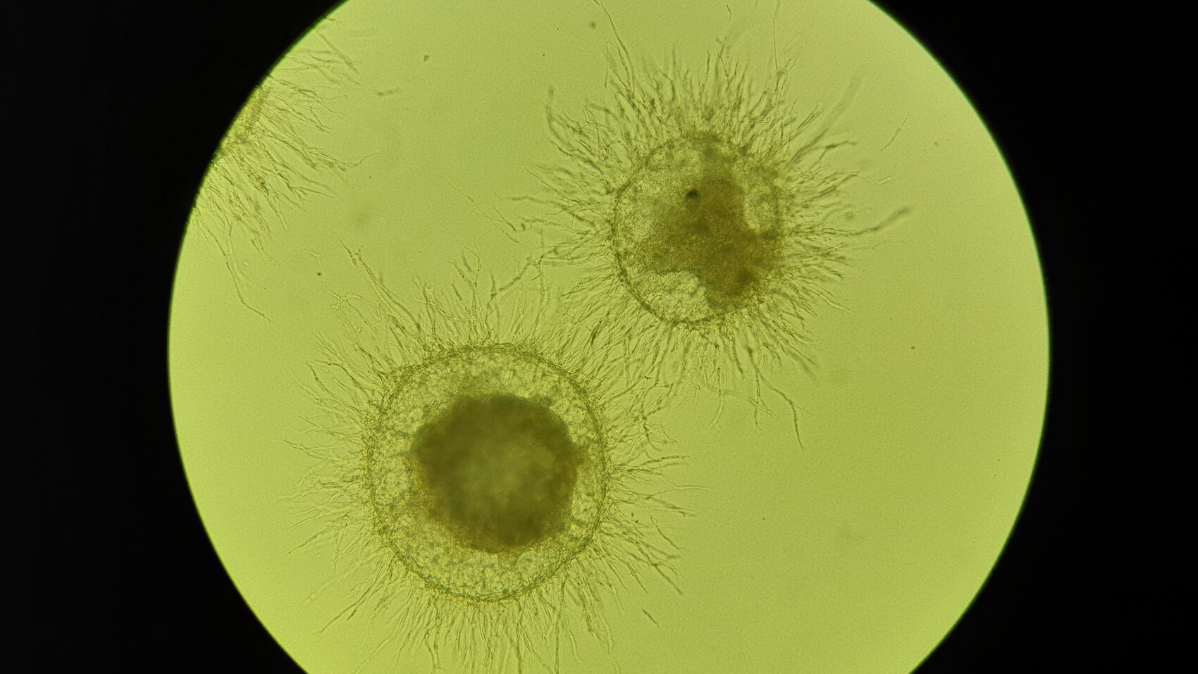 http://organoids