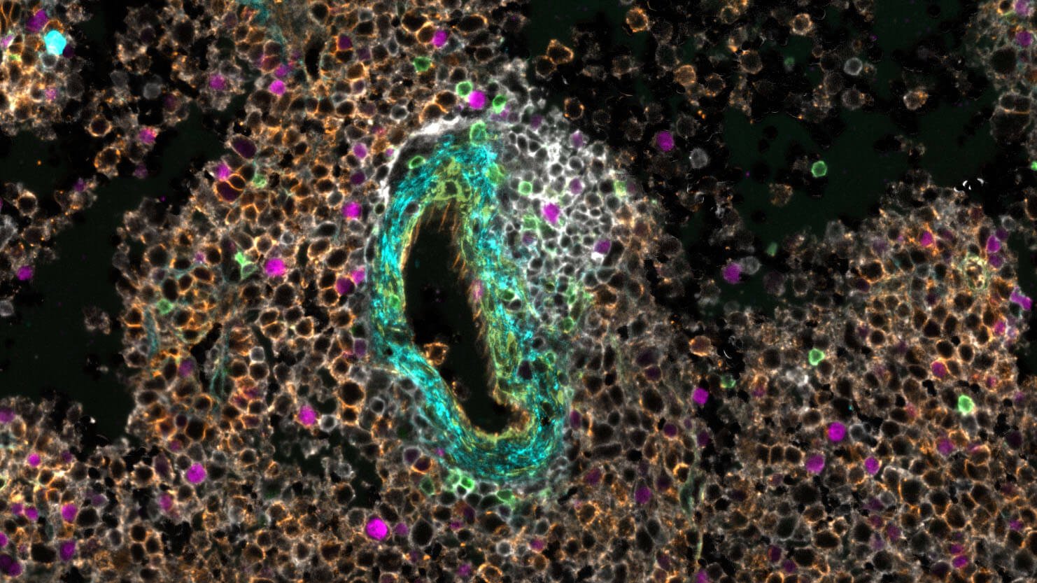 individual cells segmented for oncology research