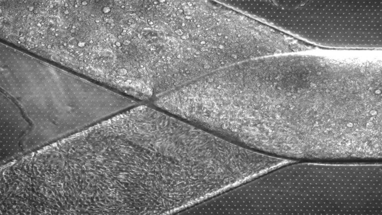 Black and white image of a fusion of silicone and human cells designed to mimic the heart’s mechanics.