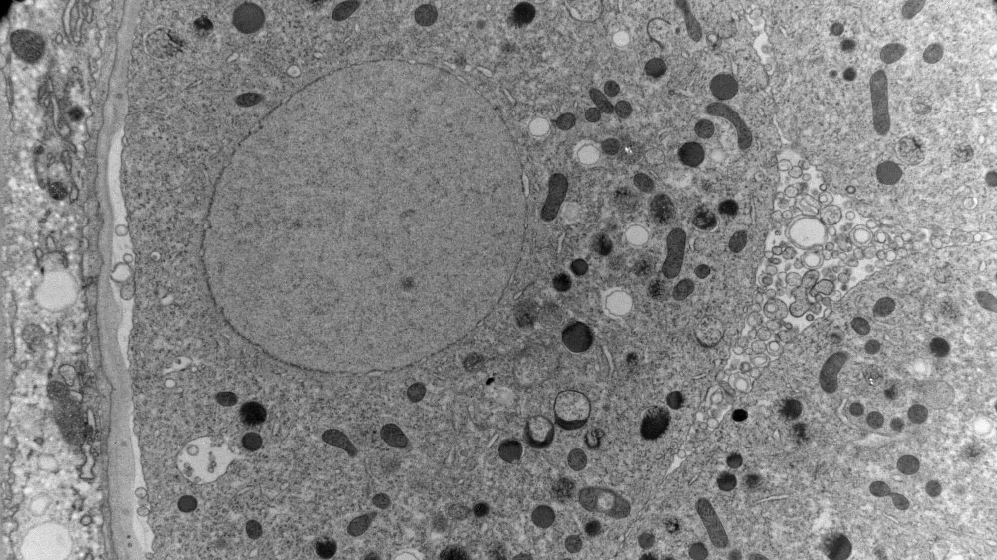 http://Electron%20Microscopy%20Image%20related%20to%20ADI%20project