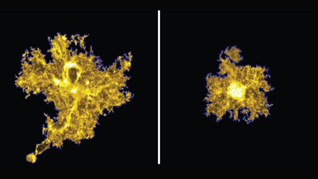 star-shaped brain cells known as astrocytes