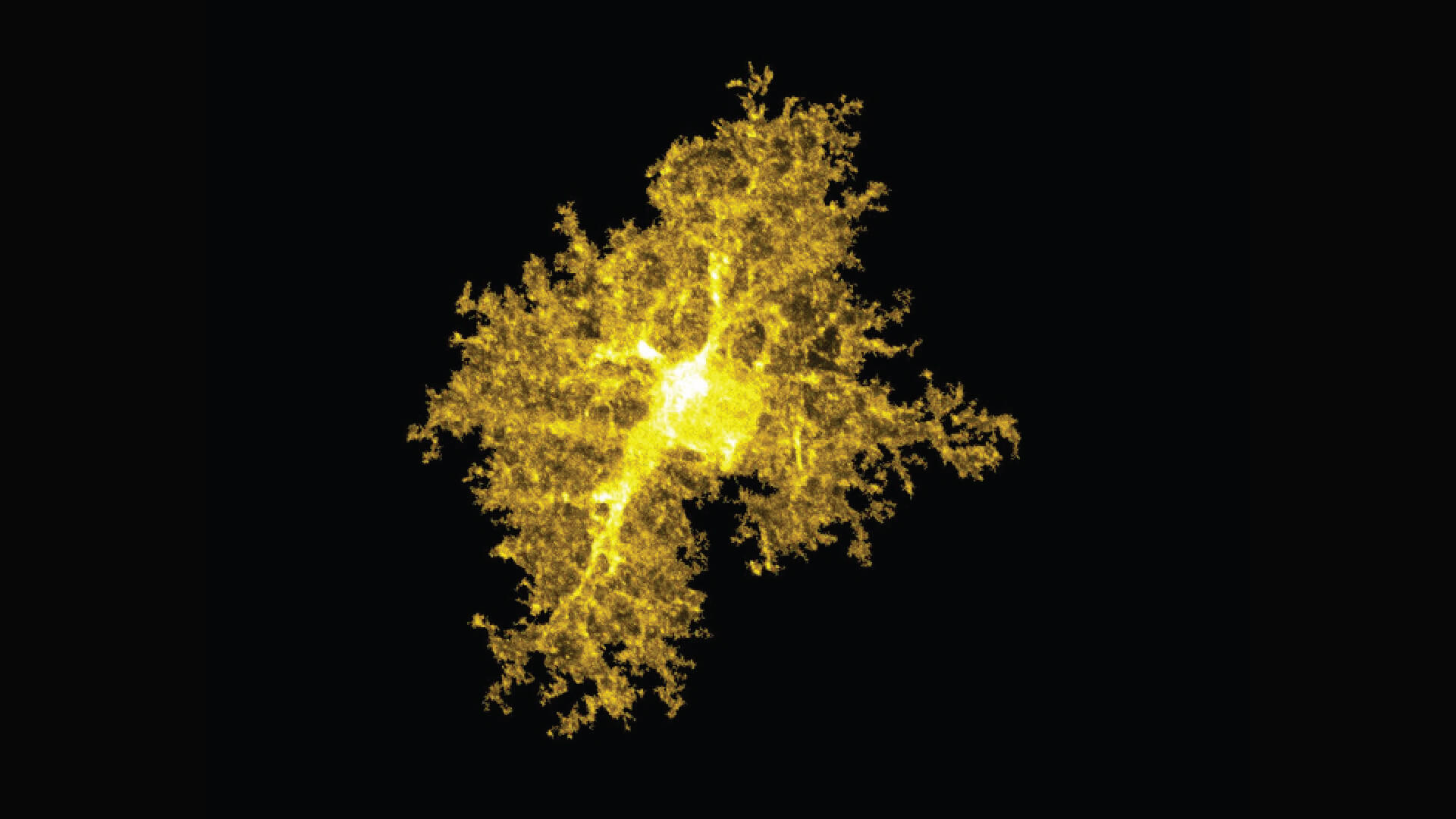 http://An%20astrocyte%20from%20the%20striatum