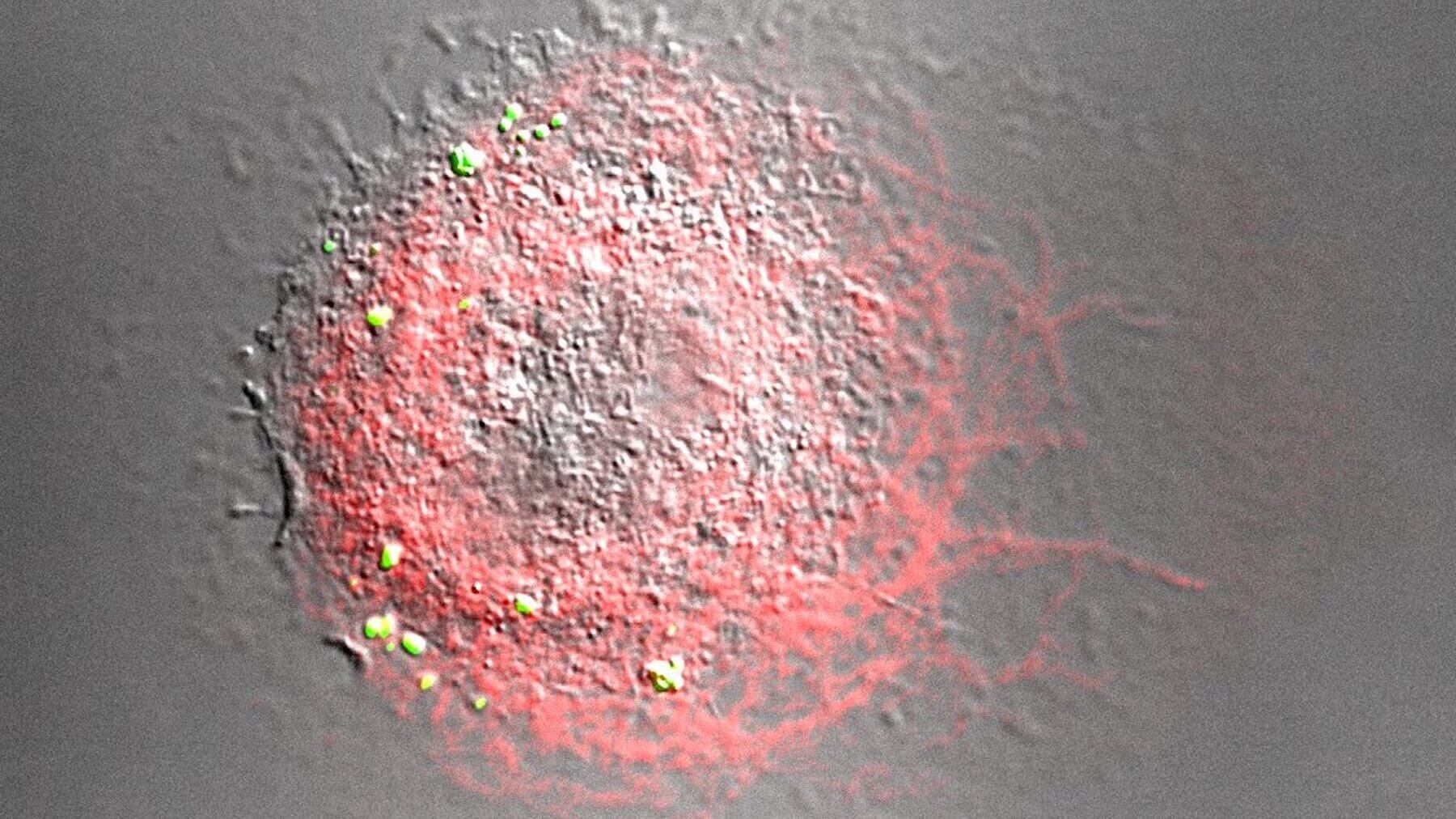 http://Microscopic%20view%20of%20a%20macrophage%20with%20actin%20highlighted%20in%20red%20and%20antibody-coated%20beads%20in%20yellow