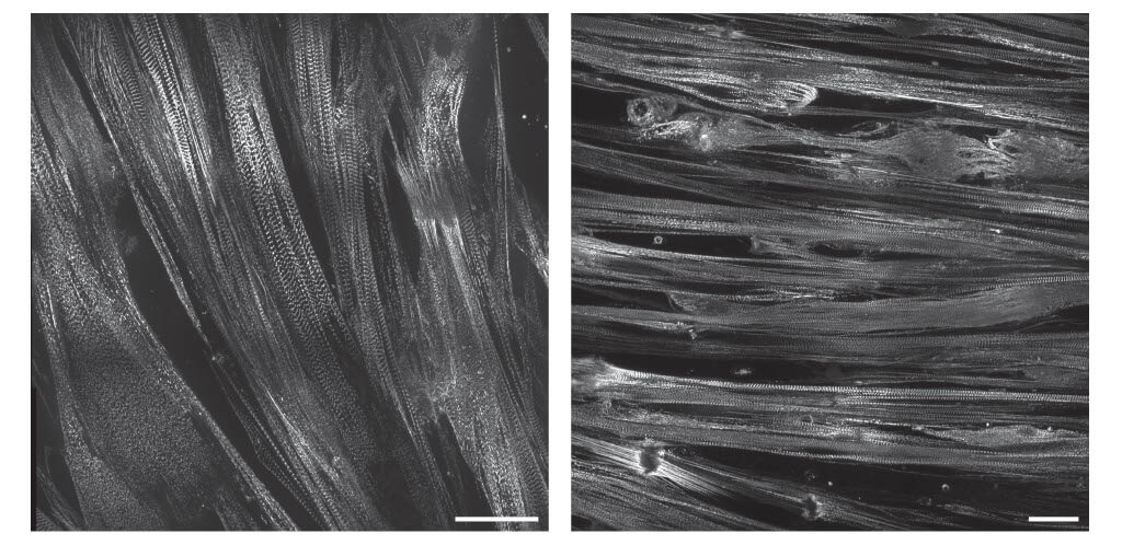 Side by side comparison of skeletal myopathy