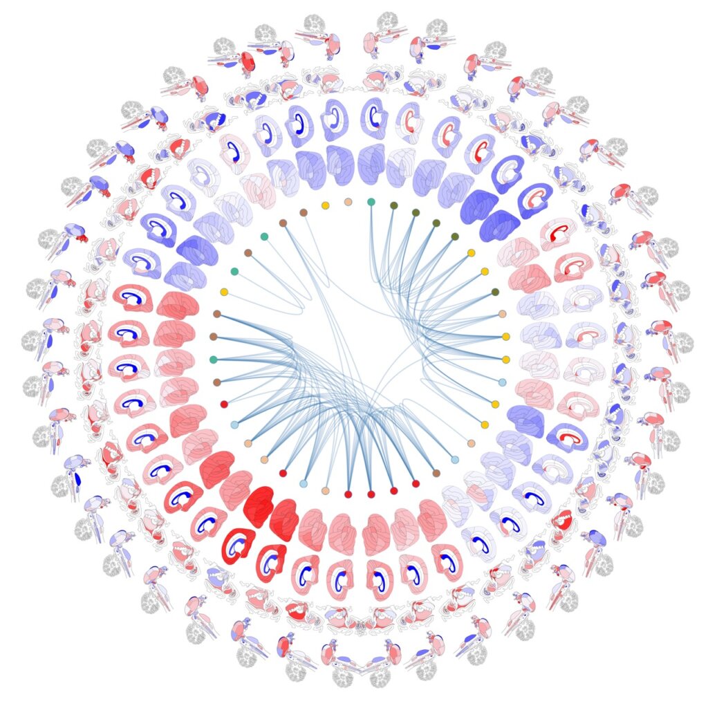 A comparison of anatomic and cellular transcriptome structures across 40 human brain diseases
