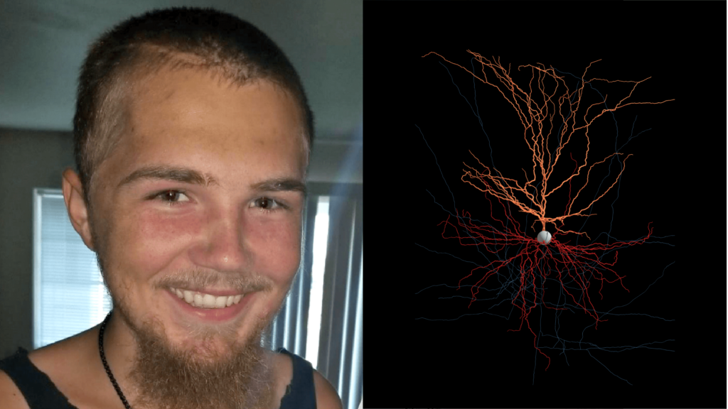 Casey neurosurgery