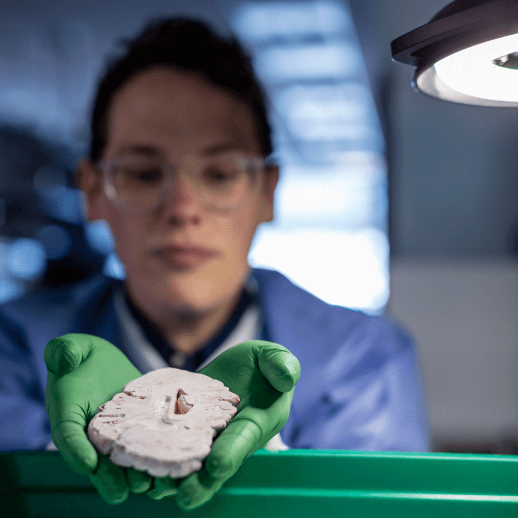 Researcher holding human brain section.